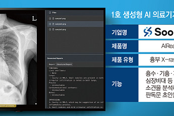 생성형 AI 의료기기 시대 개막…의료AI 시장 판도 바뀔까 [의료AI 고도화①]