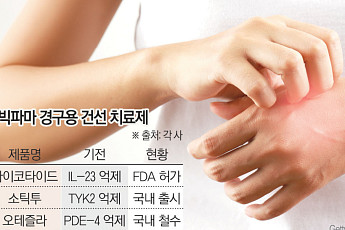 완치 불가능 건선…효과 높고 복약 편한 ‘차세대 신약’ 나올까