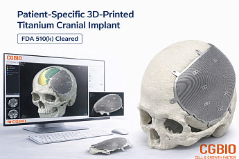 시지바이오, 환자맞춤형 티타늄 임플란트 ‘이지메이드 TI’ 美 FDA 허가