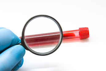 갑자기 찾아오는 ‘급성골수성백혈병’…조기 진단이 관건[e건강~쏙]