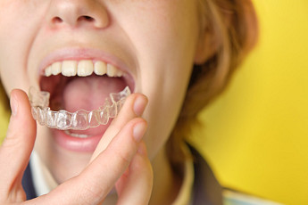 치아교정에도 ‘골든타임’…“7세 첫 검진, 평생 치열 좌우”[e건강~쏙]