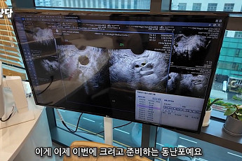 “난자 7개 준비돼 있습니다”…난자 동결 2주 프로젝트, 사실상 임신 준비 같아 [붙잡은 미래, 냉동난자 上]