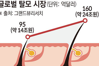 1000만 탈모인, ‘게임체인저’ 기다린다[자라나라 머리머리]