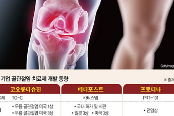 미충족 수요 큰 ‘골관절염’…해외에서 잘 나가는 국산 신약들[K-제약 글로벌 확장②]
