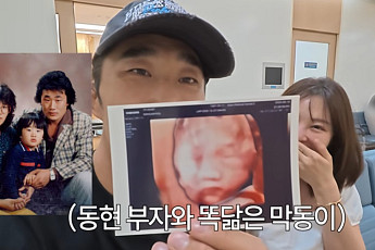 김동현, 넷째 초음파 공개⋯