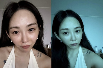 권민아, 의료사고 후 회복 근황 공개⋯팬들 응원 이어져