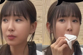 ‘성형수술 7번’ 강예원, 앞트임 복원 후 달라진 미모 눈길