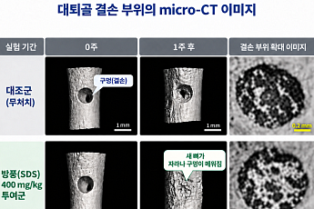 자생한방병원, 한약재 방풍의 뼈 재생 촉진 효과 최초 규명