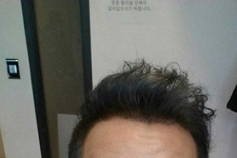 '비타민' 정준하, 아몬드 5알 생명은인 