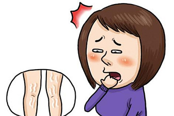 [원클릭 건강] 종아리에 보기 싫은 ‘흰줄’ 급격한 피부 팽창의 흔적