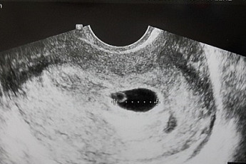 최현주·안재욱, 태명 '한방이' 뜻 공개 '이유 알고보니…' 대박!