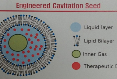 바이오인프라, 초음파 이용 BBB통과 약물전달시스템 개발