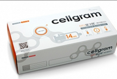 줄기세포치료제 PMS 60건은 안되고 100건은 되는 까닭