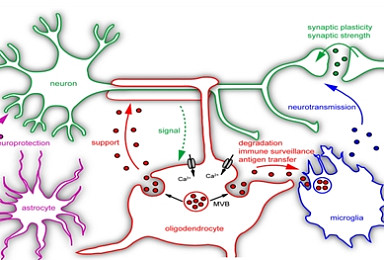 묵인희 서울대 교수가 말하는 알츠하이머 5가지 신접근법