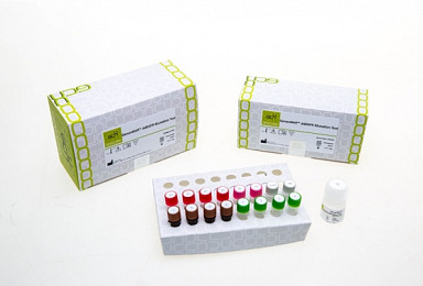 젠큐릭스 ‘비소세포폐암 동반진단키트’, 식약처 승인