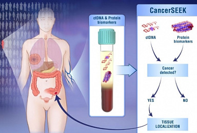 혈액으로 8종 암 다중검사법 ‘CancerSEEK' 개발