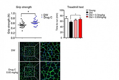 약물 재창출로 '노인성 근감소증 치료제' 후보물질 발굴