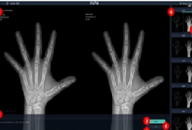 뷰노, 국내 첫 'AI 기반 진단보조 의료기기' 허가