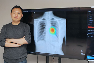 루닛, 시리즈B로 160억 투자유치..