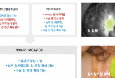 셀비온, 형광영상유도수술용 조영제 개발 본격화