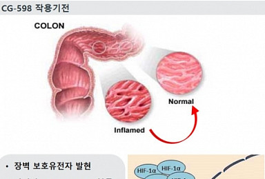 크리스탈, 염증성장질환 신약후보 발굴..특허 출원