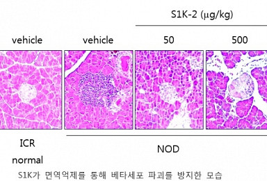 엔솔바이오, '제1형 당뇨병' 펩타이드 신약후보물질 발굴