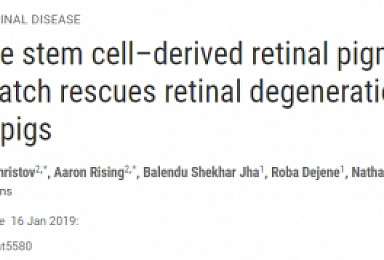 美 NIH, 역분화줄기세포로 AMD 치료 가능성 확인