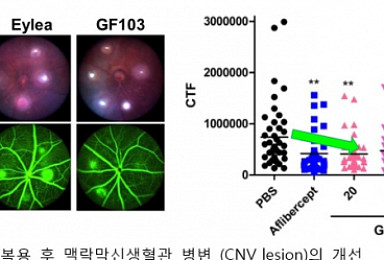 제노포커스, '美 임상 예정' AMD신약 효능평가 공개
