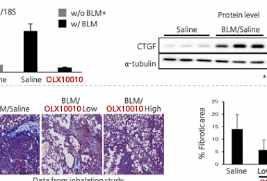 올릭스, IPF RNAi 치료제 도전..내년 美 1상 신청