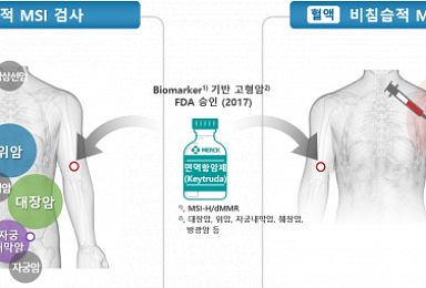 시선바이오, MSI 검사키트 국내 특허 획득