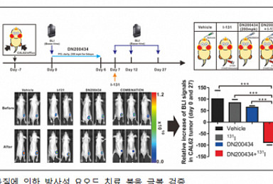 'ERRγ 단백질' 표적 미분화갑상선암 신약물질 발굴
