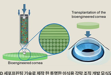 포스텍 연구팀, 3D프린팅으로 인공각막 제작