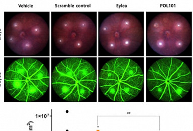 시선테라퓨틱스, 습성AMD치료제 비임상 효능평가 공개