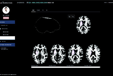 JLK인스펙션, AI 뇌졸중·전립선암 솔루션 CE 인증