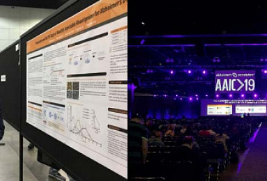 지투지바이오, 서방형 도네페질 주사제 개발현황 공개