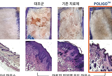 시선테라퓨틱스, 유럽서 'ASO 아토피 신약후보' 공개