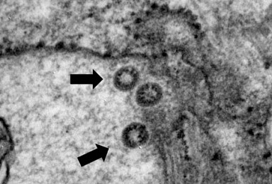 국내 환자 '신종 코로나 바이러스' 유전체 분석결과는