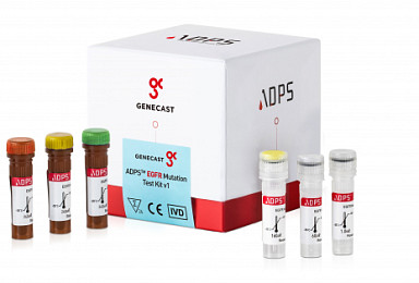 진캐스트, 143억 시리즈B 유치 