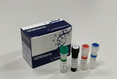 프로테옴텍, 코로나19 분자진단 수출 허가 획득