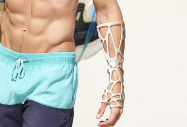 티앤알바이오팹, 3D프린팅 부목 ‘엑스켈렛’ 식약처 허가