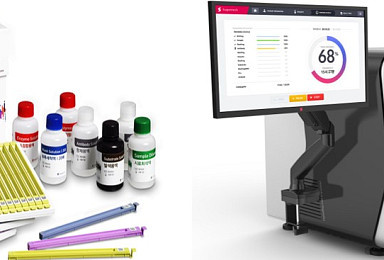 수젠텍, 혈액기반 ‘알레르기 진단&분석시스템’ 출시