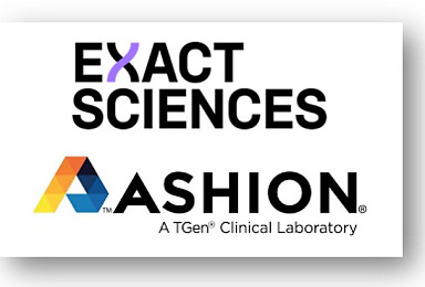 이그젝, 액체생검 '애쉬온' 인수..”MRD 진단 강화”