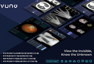 뷰노, 국내 첫 ‘혁신의료기기 SW 제조기업’ 인증