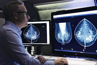 루닛, 유럽 5.5만명 유방암검진서 'AI 검증'..