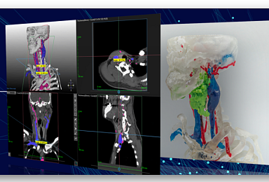 메디컬아이피, 시리즈C 200억..