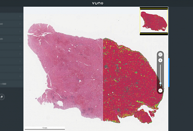 뷰노, AI 간암 연구결과 발표..