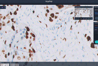 뷰노, ‘암 바이오마커 정량화’ AI 솔루션 식약처 인증