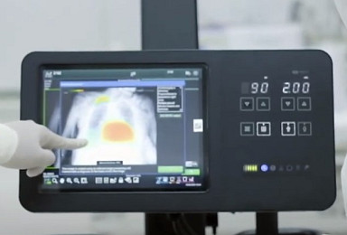 루닛-후지필름, AI 폐진단 'CXR-AID’ “日 PMDA 인증”