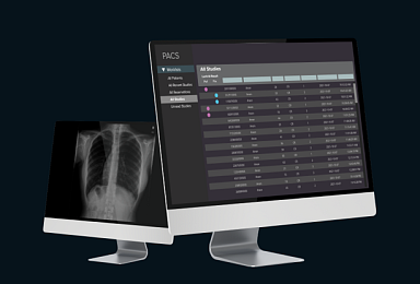 루닛, AI 응급질환 분류 'CXR 트리아지' 