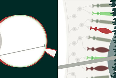 伊아방가르드, 시리즈B 1.4억弗..